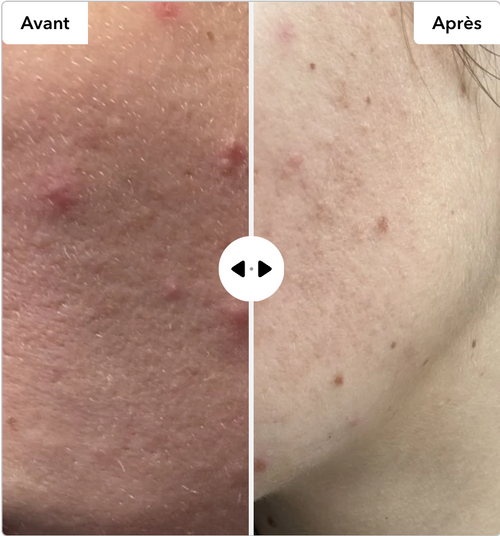Avant / Après